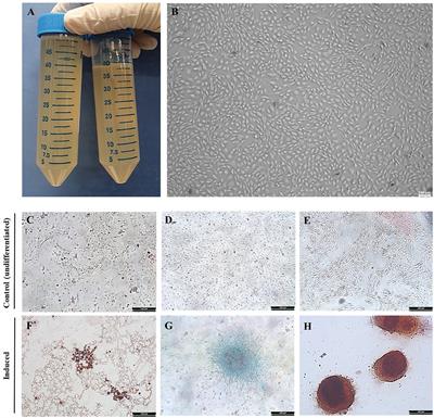 Evaluation of stability and safety of equine mesenchymal stem cells derived from amniotic fluid for clinical application